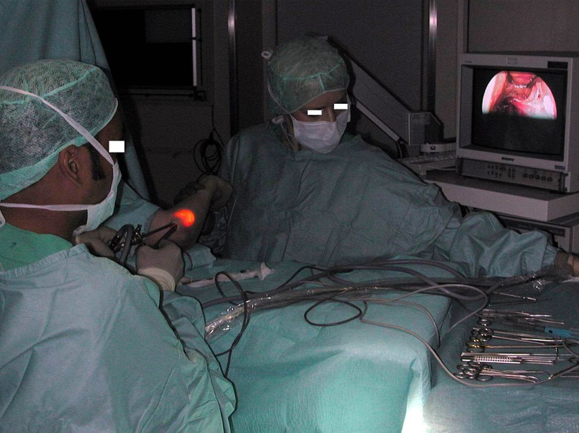 This is how the operation is done This is how the operation is done